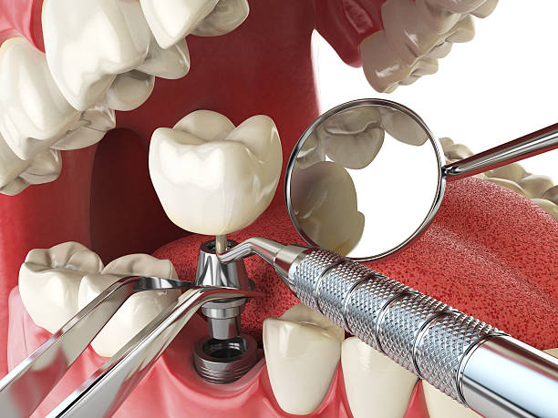 Best Emergency Dental Services for Seniors in Yellow Springs, OH